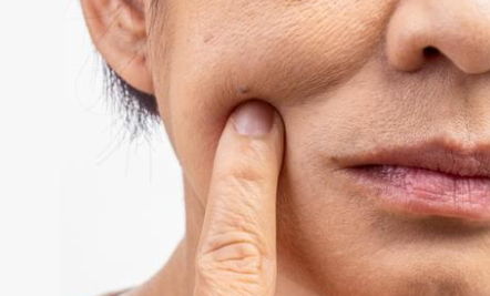 woman's face up close with finger on cheek, referencing collagen banking