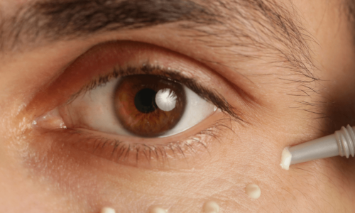 Women putting cream dots under her eyes to prevent under eye wrinkles