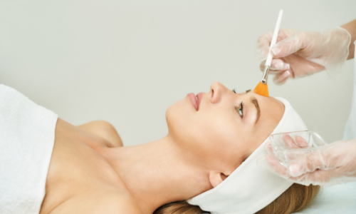 chemical peel