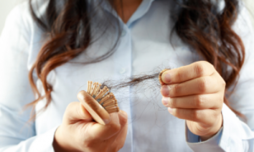 women holding comb with fallen hair