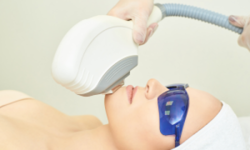 ipl photofacil treatment for women