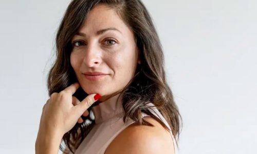 botox helps you age gracefully