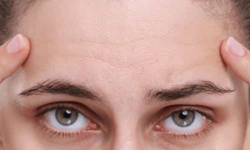 Close up of women furrowing her brow showing wrinkled forehead